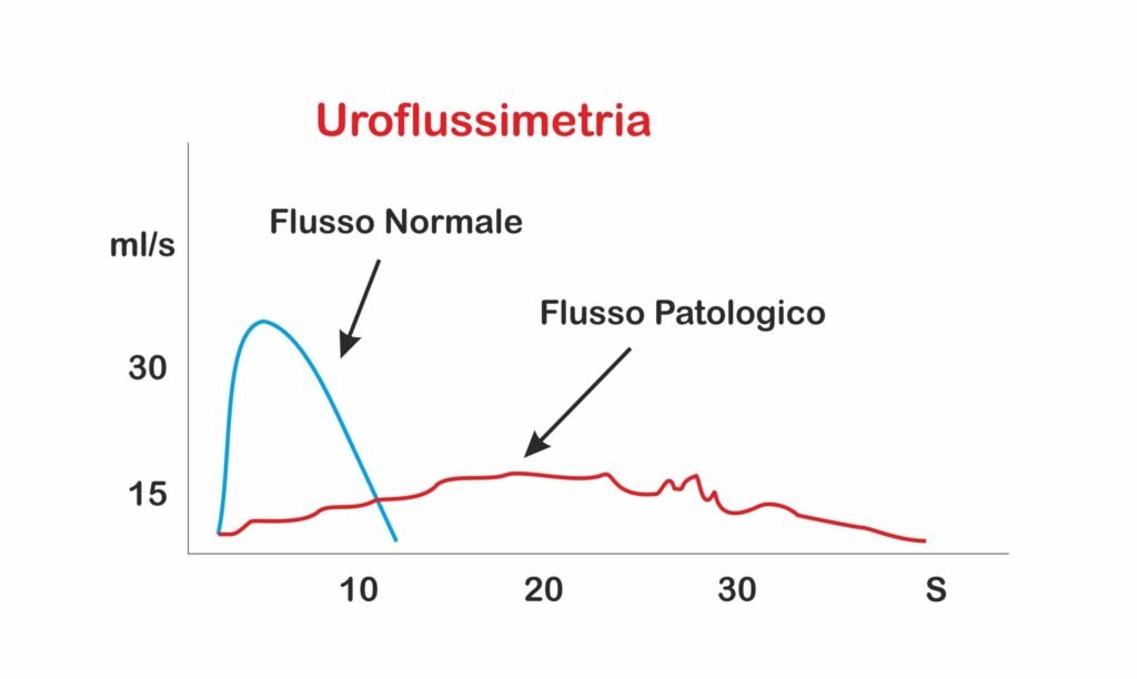 Uroflussimetria con determinazione del residuo a cassino presso la figebo