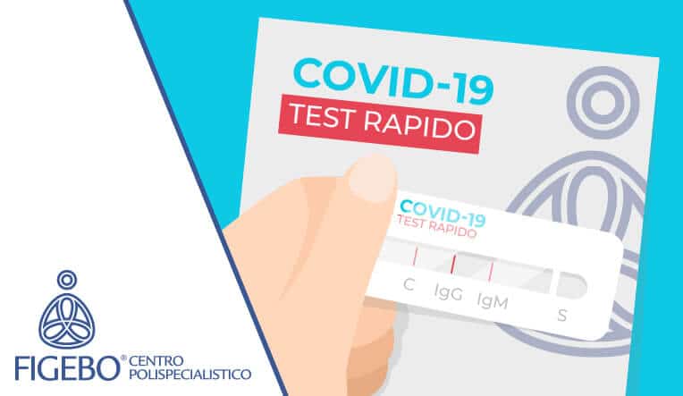 Test-rapido-Covid-19-figebo-cassino