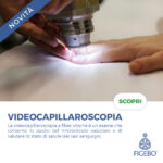 Videocapillaroscopia