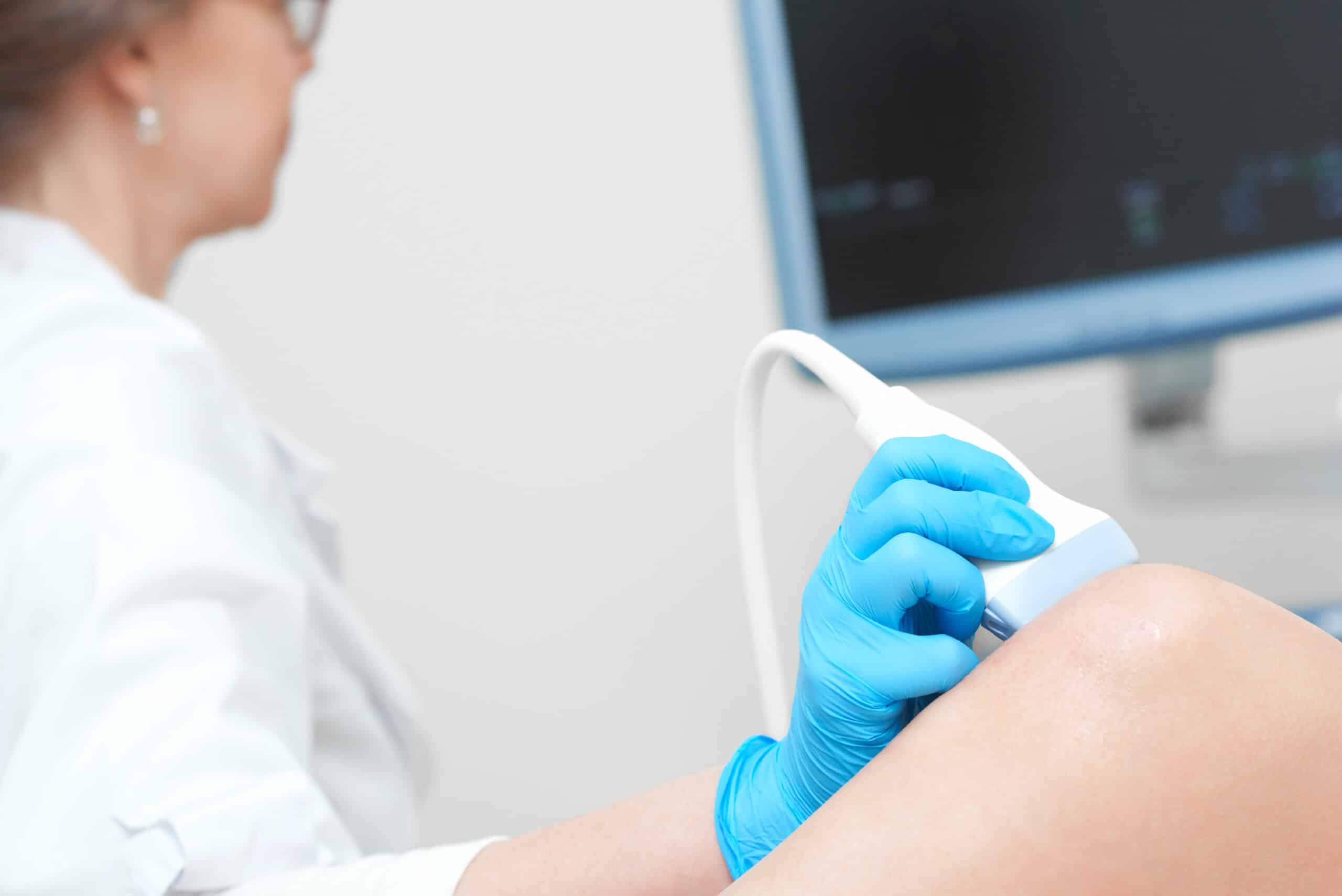Gonfiore alle gambe: problema circolatorio?