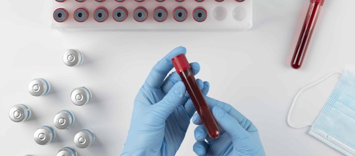 Azotemia alta nelle analisi del sangue: cosa vuol dire?